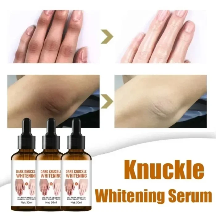 Brightens Private Part Skin Elbow Armpit Lightens Melanin Brightening Essence Hand Cream Moisturizes Beautifying Essential Oil - Image 5