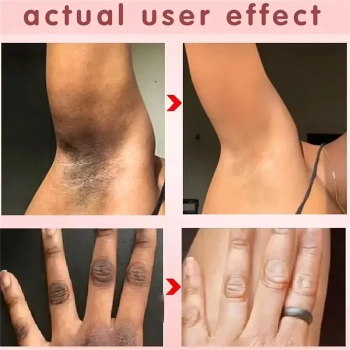 Body Whitening Soap Deep Clean Skin Chicken - Image 2