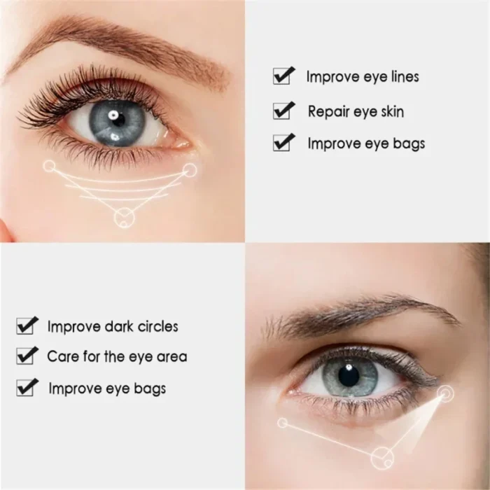 Nicotinamide Eyes Cream Dark Circles Remove Eye Bags Under Eye - Image 4