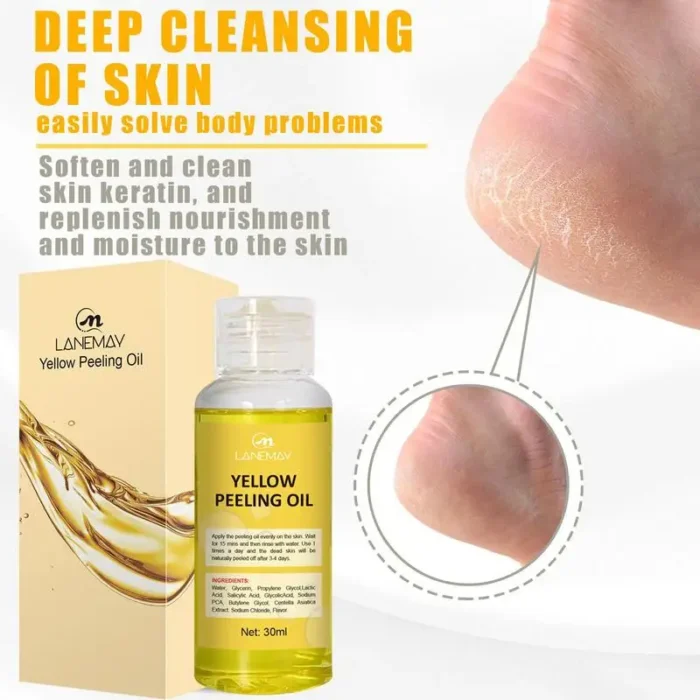 1pcs Yellow Peeling Oil Dark Skin Bleaching Remove Arm Knee Legs Melanin Body Brighten Scrub Whiten Exfoliating Dead Skin Care - Image 6