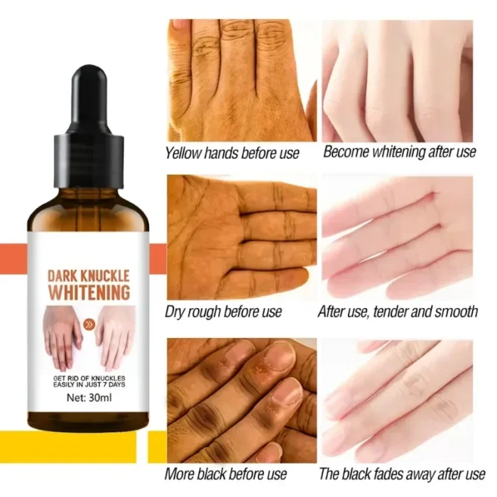 Brightens Private Part Skin Elbow Armpit Lightens Melanin Brightening Essence Hand Cream Moisturizes Beautifying Essential Oil - Image 6