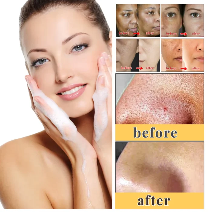 Body Whitening Soap Deep Clean Skin Chicken - Image 6