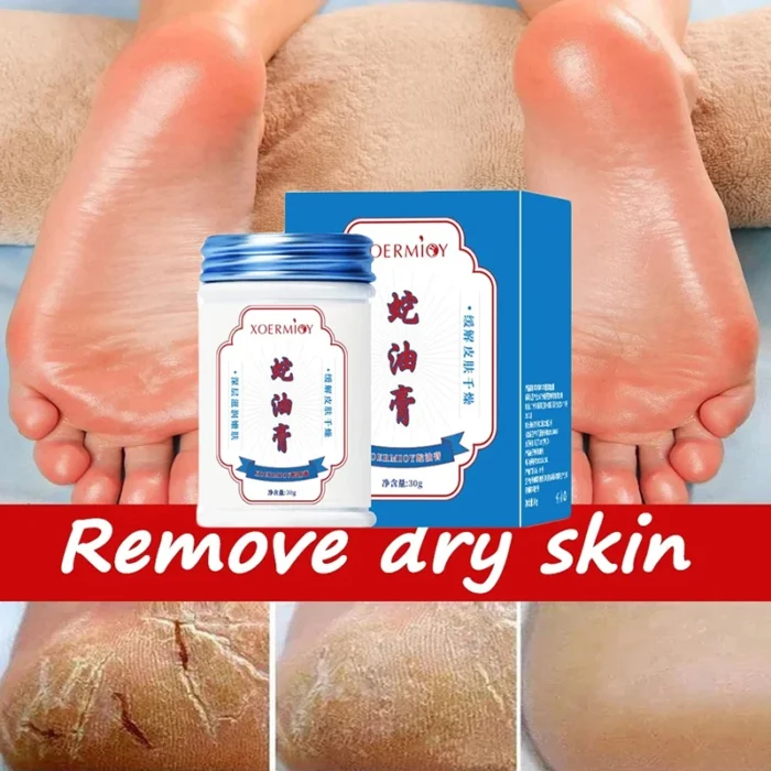 Herbal Anti Crack Foot Cream Heel Crack Repair Products Exfoliating Dead Skin Removal Softening Moisturising Smoothing Skin Care - Image 3