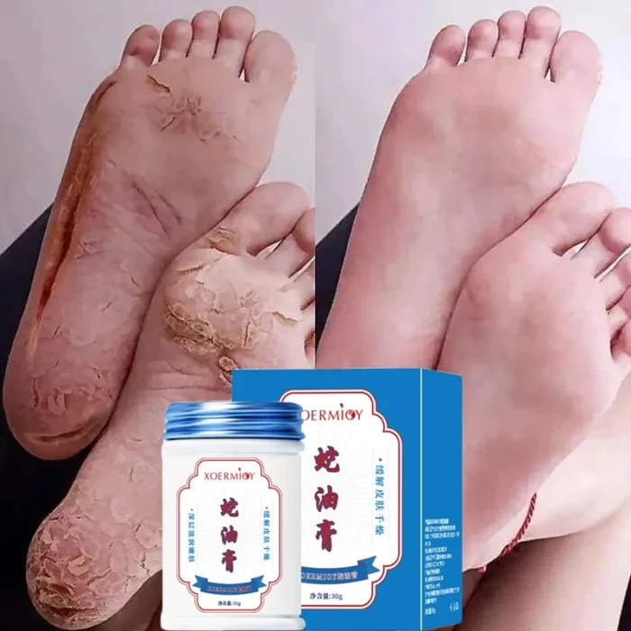 Herbal Anti Crack Foot Cream Heel Crack Repair Products Exfoliating Dead Skin Removal Softening Moisturising Smoothing Skin Care - Image 2