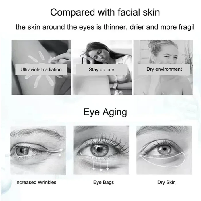 Nicotinamide Eyes Cream Dark Circles Remove Eye Bags Under Eye - Image 5