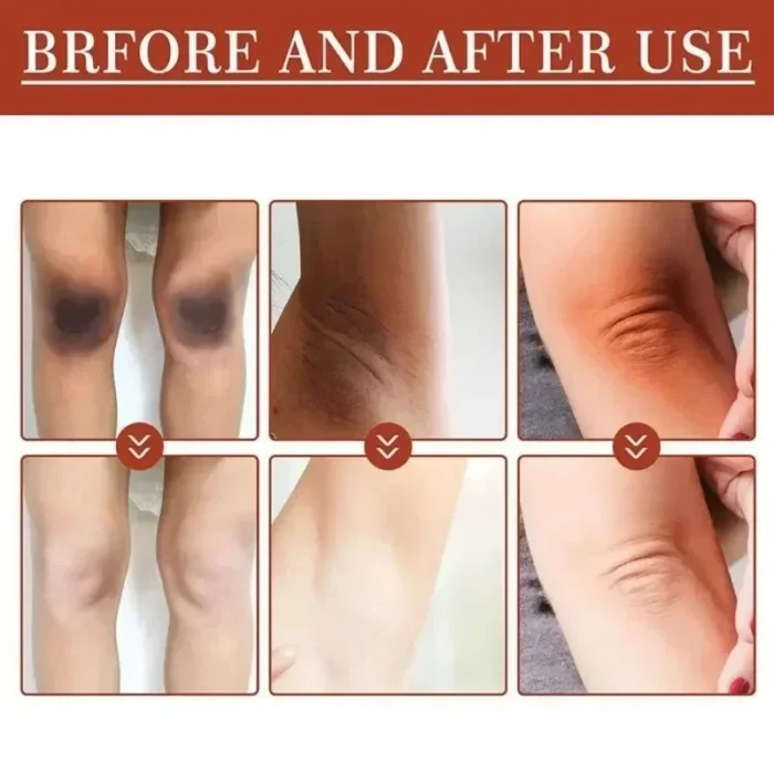 Brightens Private Part Skin Elbow Armpit Lightens Melanin Brightening Essence Hand Cream Moisturizes Beautifying Essential Oil - Image 4