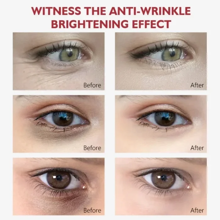 Nicotinamide Eyes Cream Dark Circles Remove Eye Bags Under Eye - Image 2