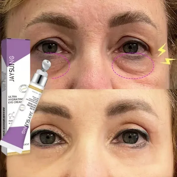 Age group 45–55 years - Image 14