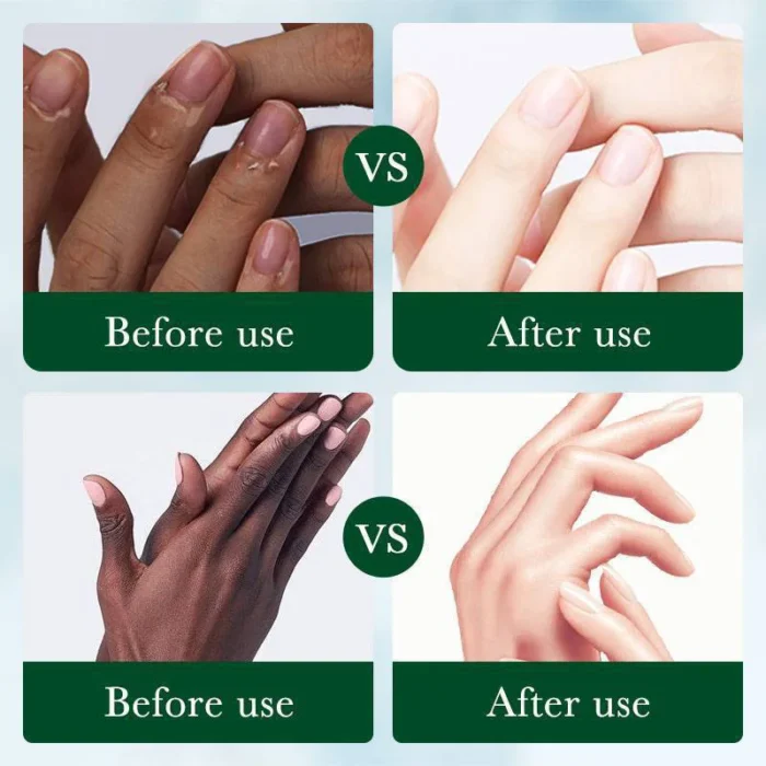 Fast Brighten Dark Knuckles Cream Whiting Hand Cream Lighten Melanin Stains Corrector Hand Anti Crack Soften Moisturize Product - Image 5