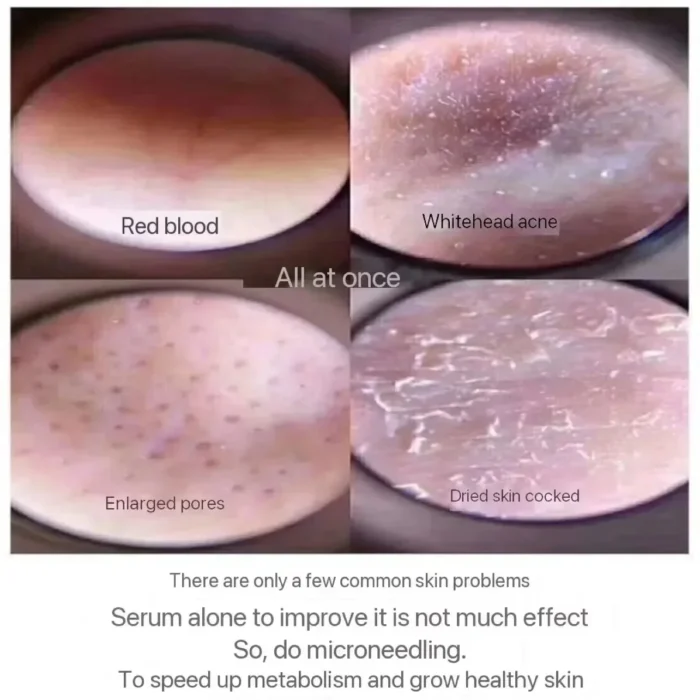 10pcs Sponge Microcrystal Freeze-dried Powder Collagen Regeneration Natural Biological Extract Sponge Spicules Skin Cell Renew - Image 3