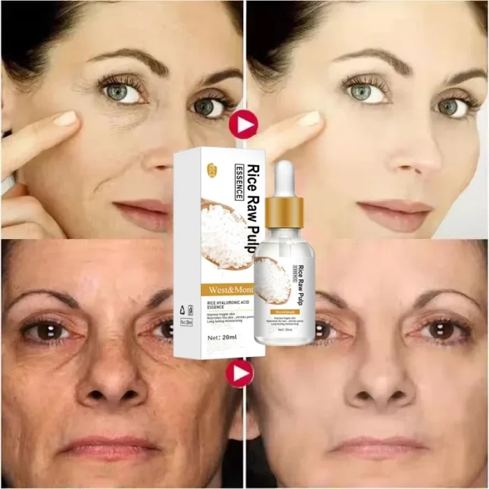 White Rice Whitening Serum Wrinkle Remover Fade Fine Lines Remove Dark Spots Melanin Anti-aging Brighten Smooth Face Skin Care - Image 3