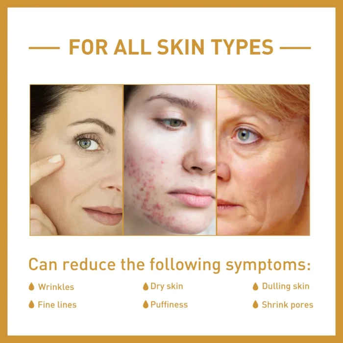 White Rice Whitening Serum Wrinkle Remover Fade Fine Lines Remove Dark Spots Melanin Anti-aging Brighten Smooth Face Skin Care - Image 5